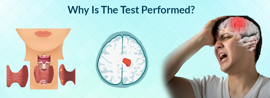 Why Is The Test Performed